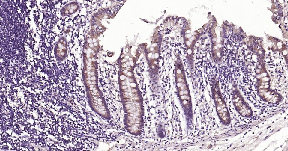 Anti-Beclin-1 Antibody (8U829)