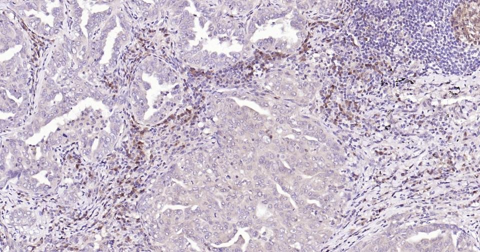 Anti-Caspase-3 Antibody (2P196)