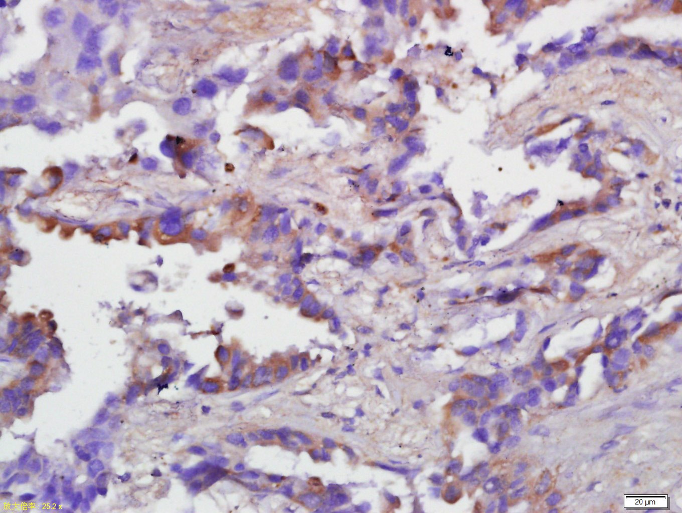 Anti-Caspase-1 p20 Polyclonal Antibody 2