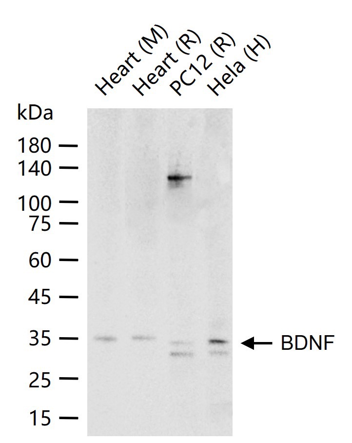 Anti-BDNF Polyclonal Antibody 3