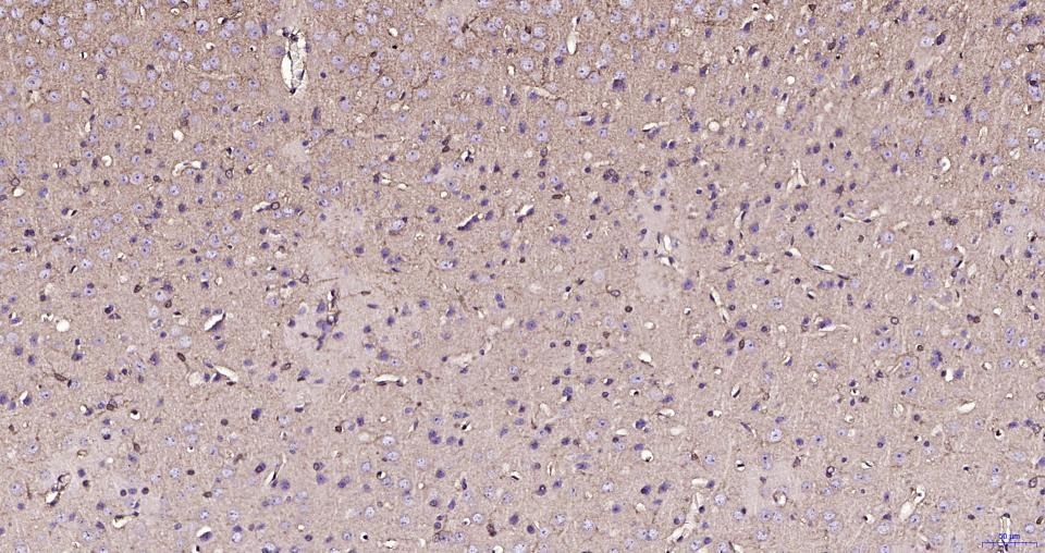 Anti-BDNF Polyclonal Antibody 3
