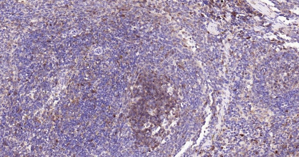 Anti-Caspase-3 Antibody (1B38)