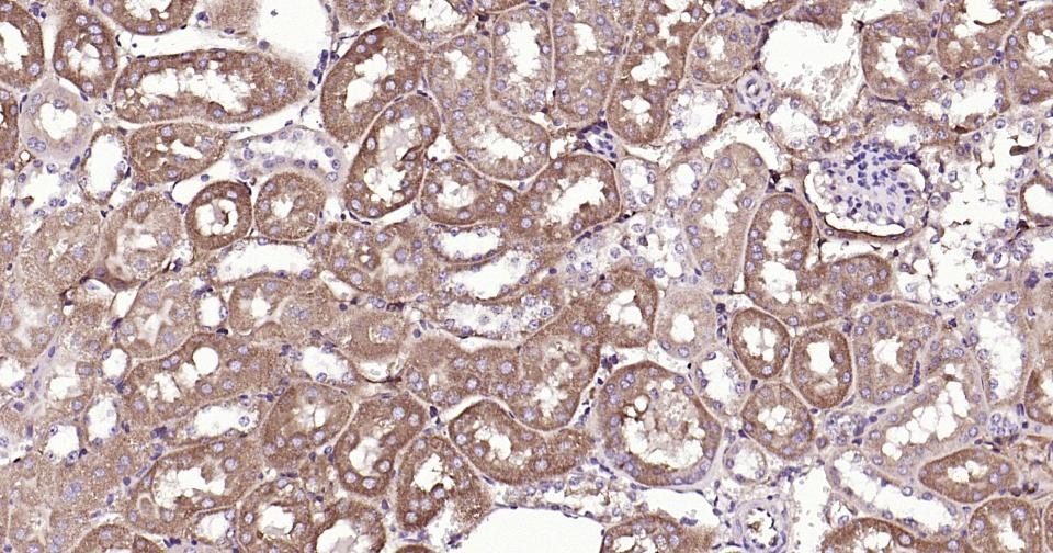 Anti-Beclin-1 Antibody (8U829)