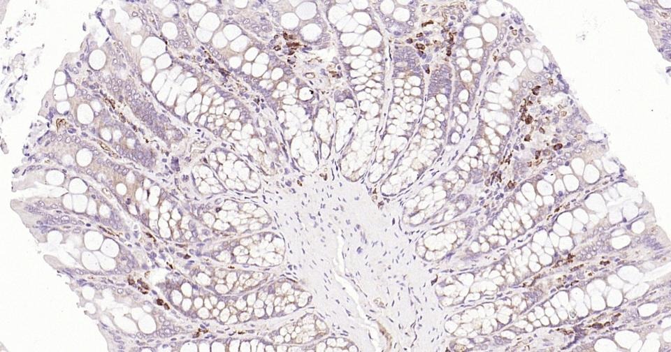 Anti-Beclin-1 Antibody (8U829)