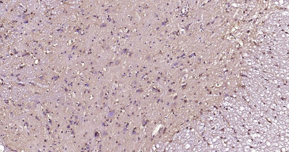 Anti-BDNF Antibody (1R78)