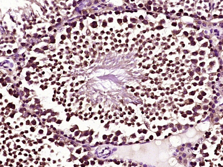Anti-BCL-XL Polyclonal Antibody