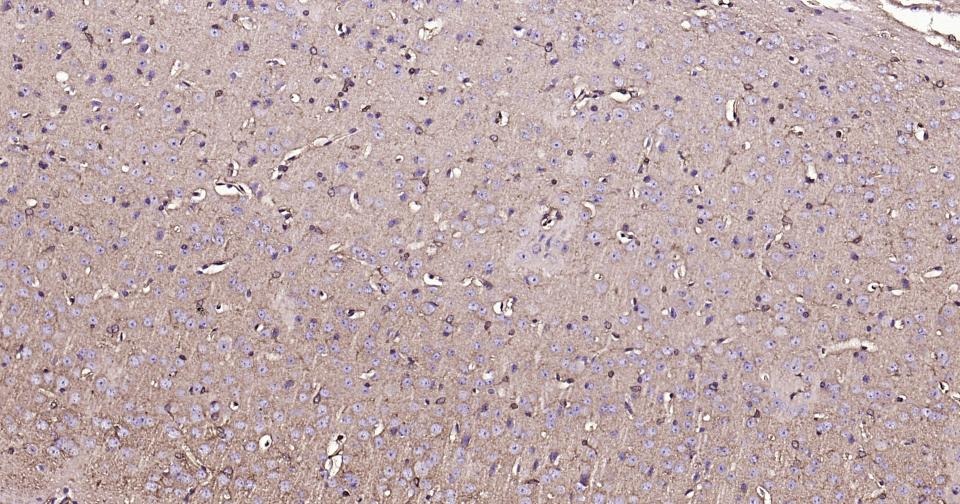 Anti-BDNF Antibody (1R78)