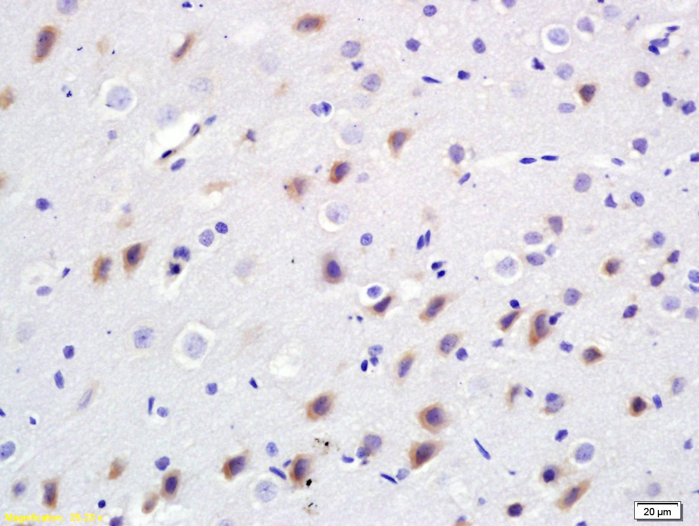 Anti-BDKRB2 Polyclonal Antibody