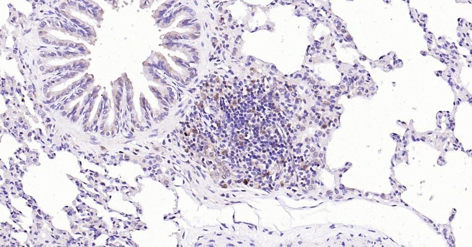 Anti-Caspase-3 Antibody (1B38)