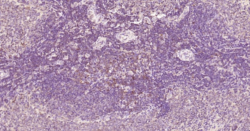 Anti-Beclin-1 Polyclonal Antibody