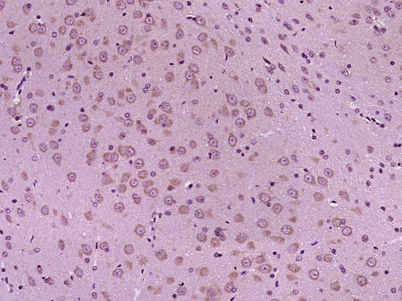 Anti-Beclin-1 Polyclonal Antibody