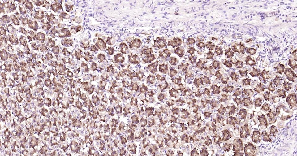 Anti-Beclin-1 Antibody (8U829)