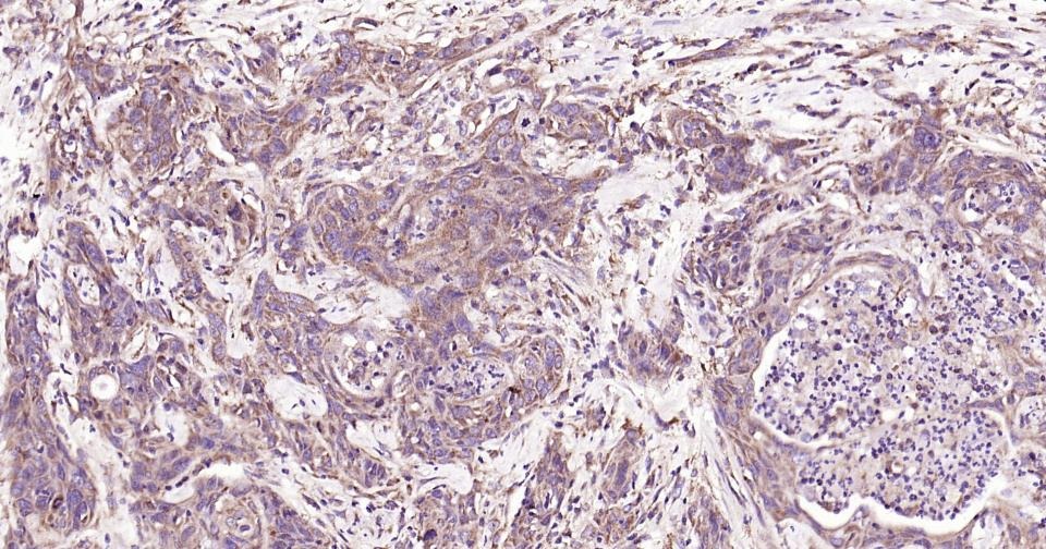 Anti-Beclin-1 Polyclonal Antibody