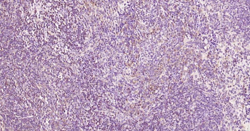 Anti-Beclin-1 Polyclonal Antibody