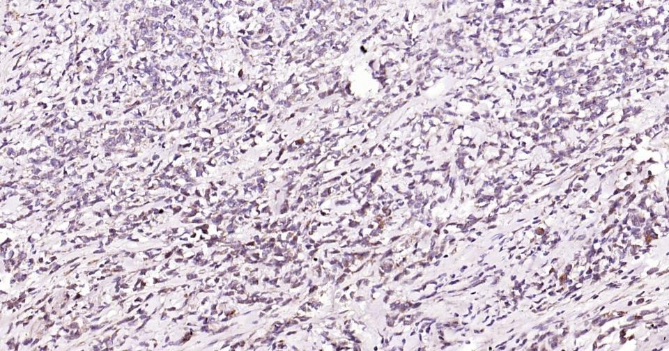 Anti-Beclin-1 Polyclonal Antibody