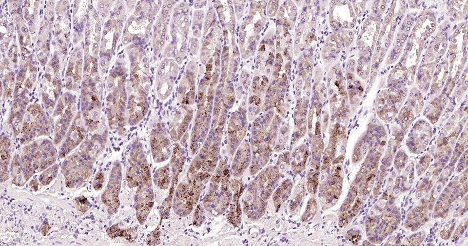 Anti-Beclin-1 Antibody (8U829)