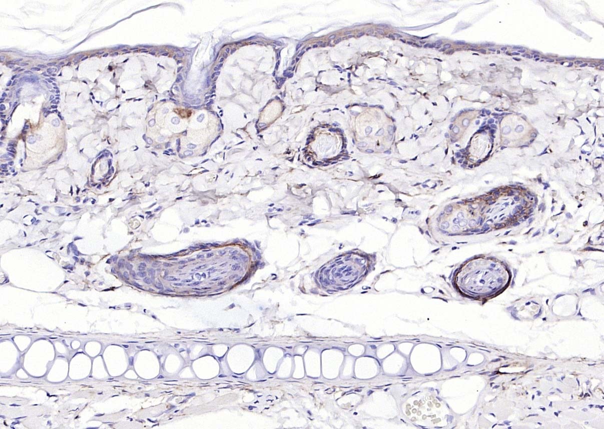 Anti-EGFR Polyclonal Antibody 3