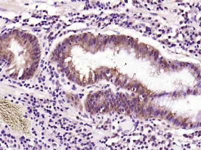 Anti-EGFR Polyclonal Antibody
