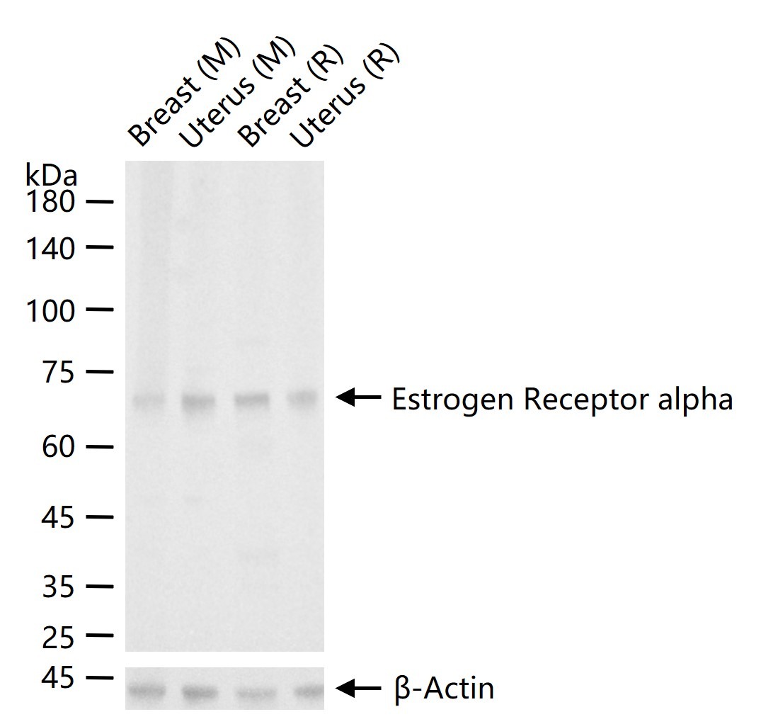 Anti-ER alpha Polyclonal Antibody