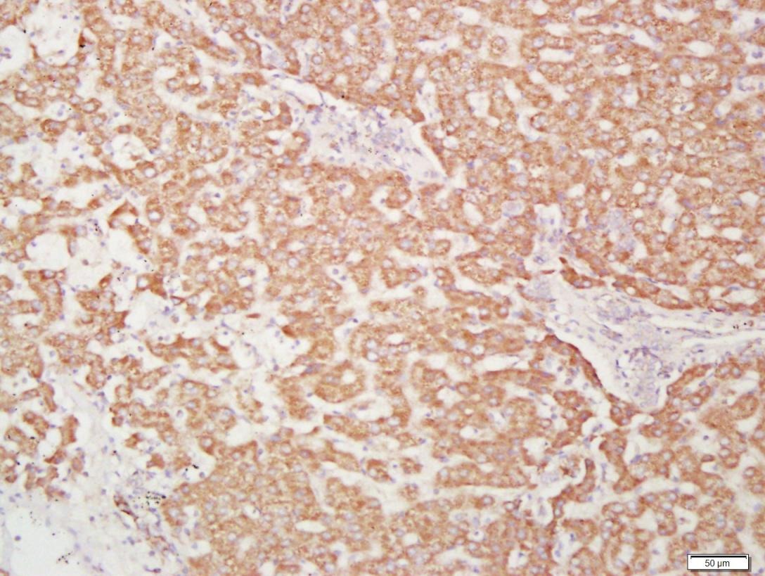 Anti-CXCR4 Polyclonal Antibody