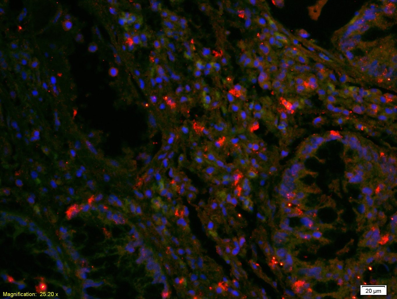 Anti-EGFR Polyclonal Antibody