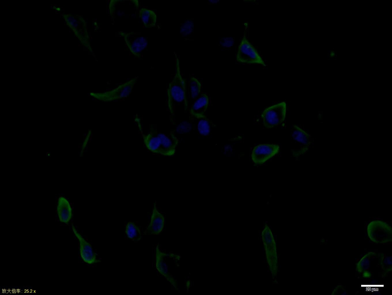 Anti-EGF Polyclonal Antibody