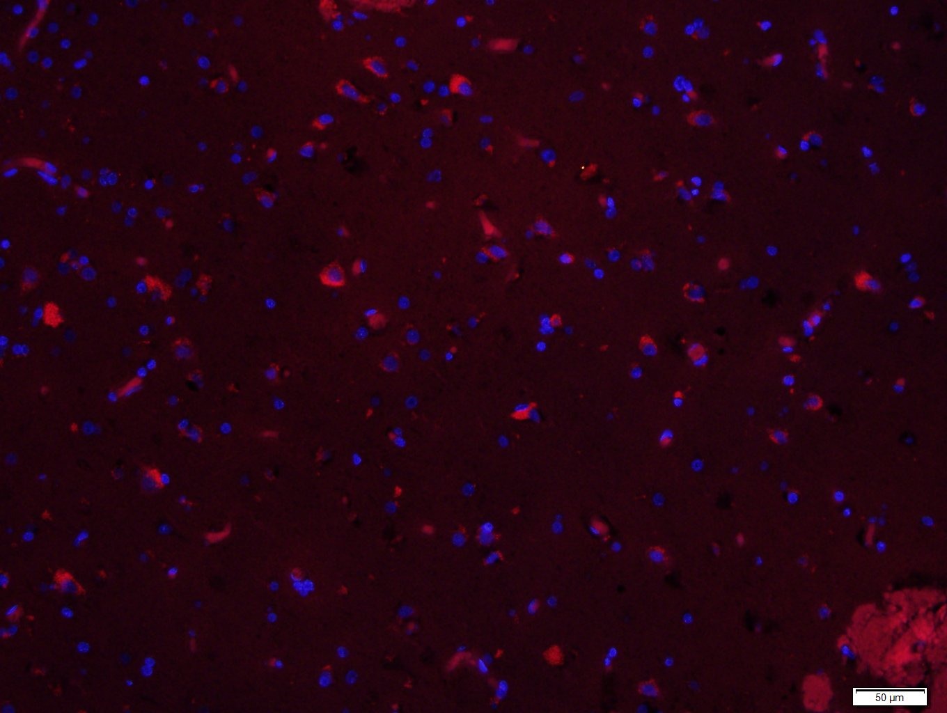 Anti-EGFR Polyclonal Antibody 2