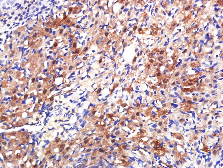 Anti-ER alpha Polyclonal Antibody 2