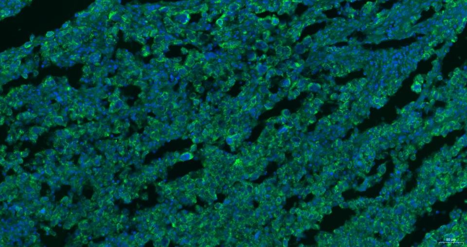 Anti-CXCR4 Polyclonal Antibody