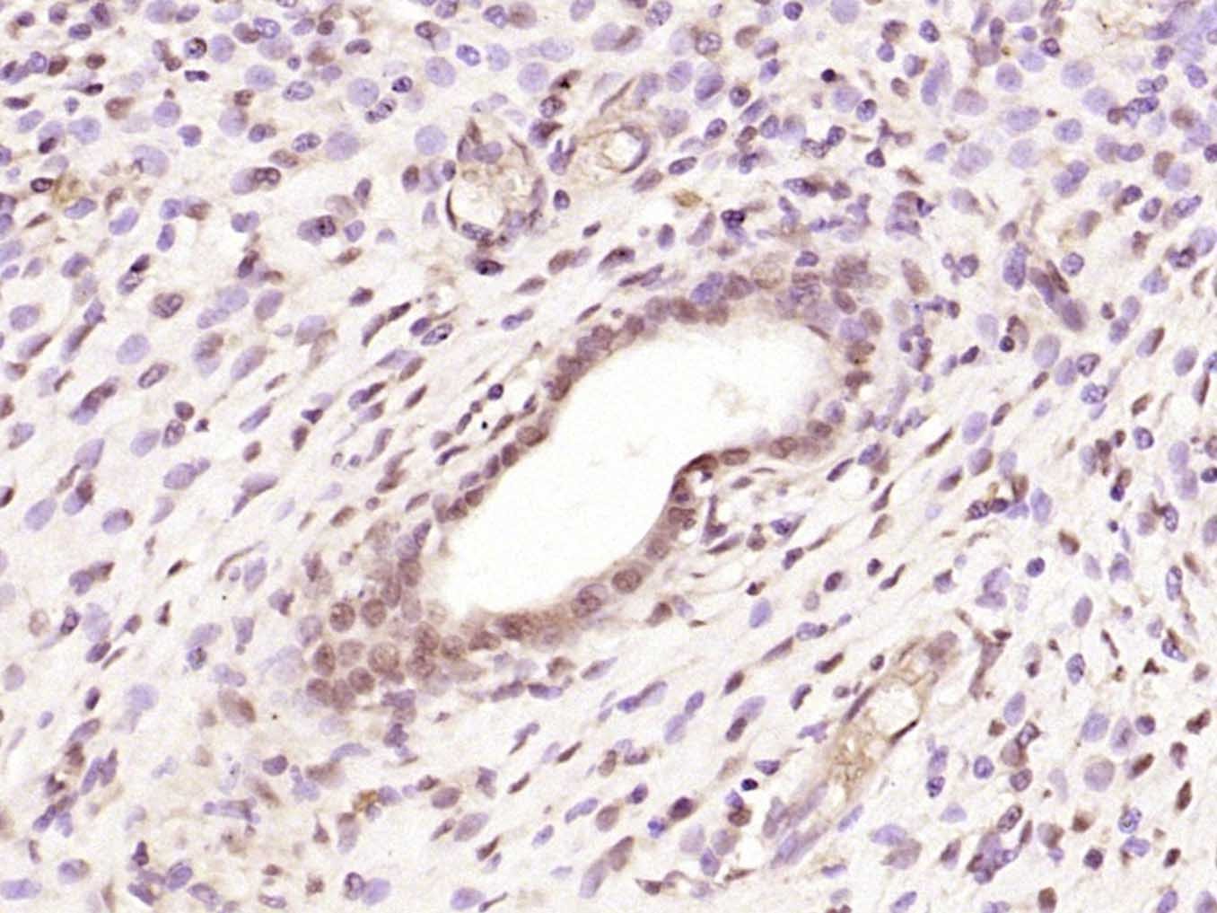 Anti-ER alpha Polyclonal Antibody 2