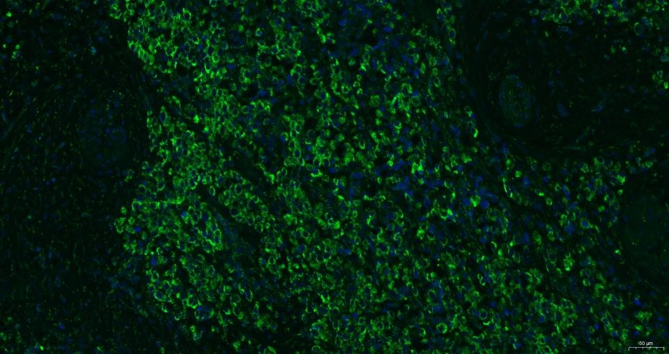 Anti-CXCR4 Polyclonal Antibody