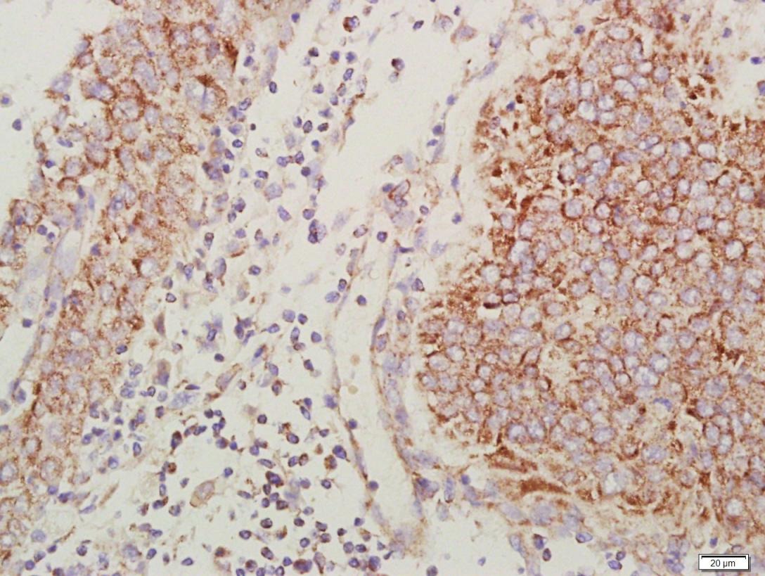 Anti-CXCR4 Polyclonal Antibody