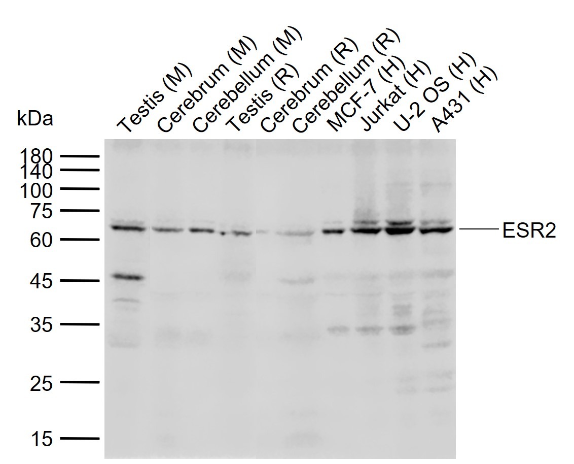 Anti-ER beta Polyclonal Antibody