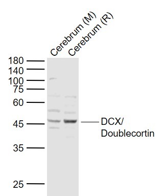 Anti-Doublecortin/DCX Polyclonal Antibody