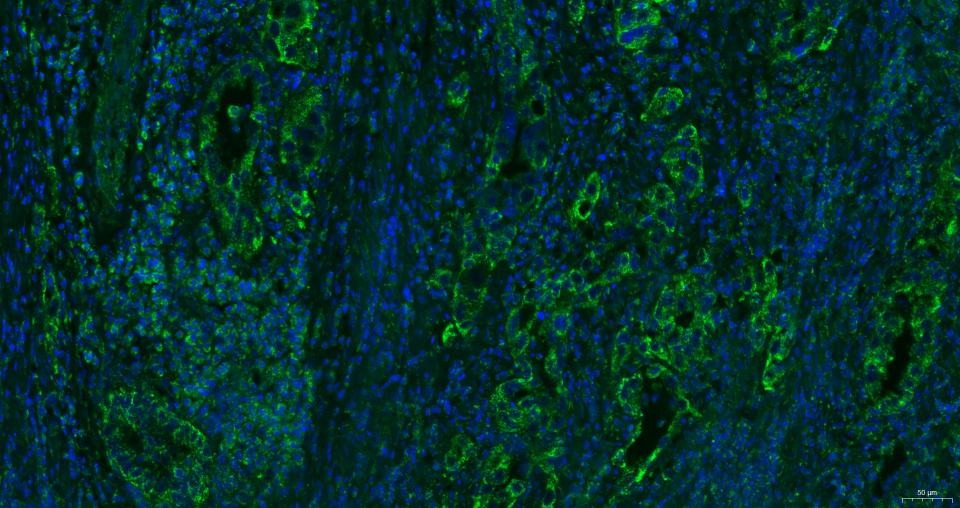 Anti-CXCR4 Polyclonal Antibody 2