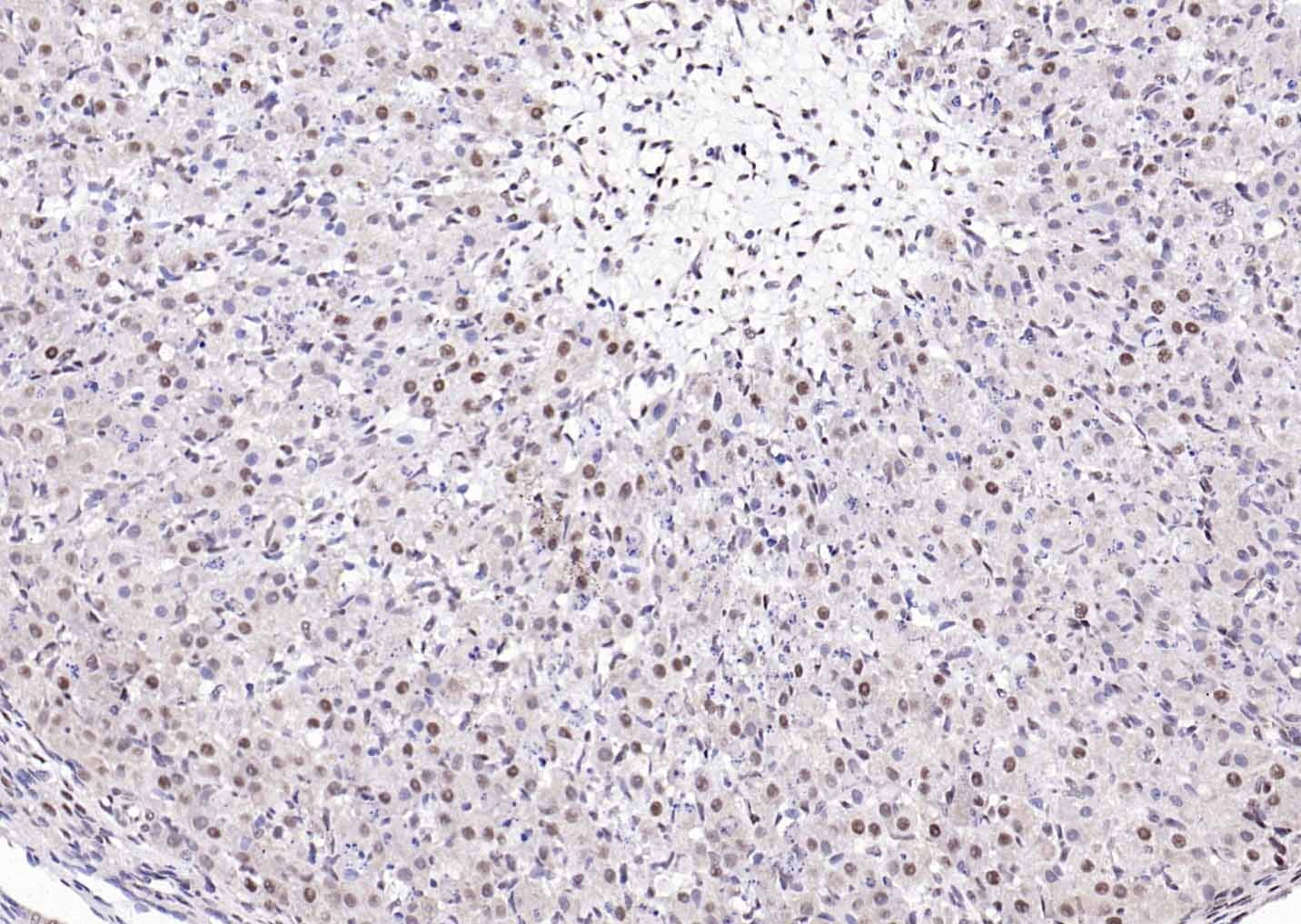 Anti-ER beta Polyclonal Antibody