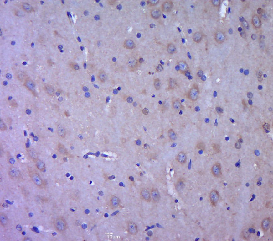 Anti-Doublecortin/DCX Polyclonal Antibody 2