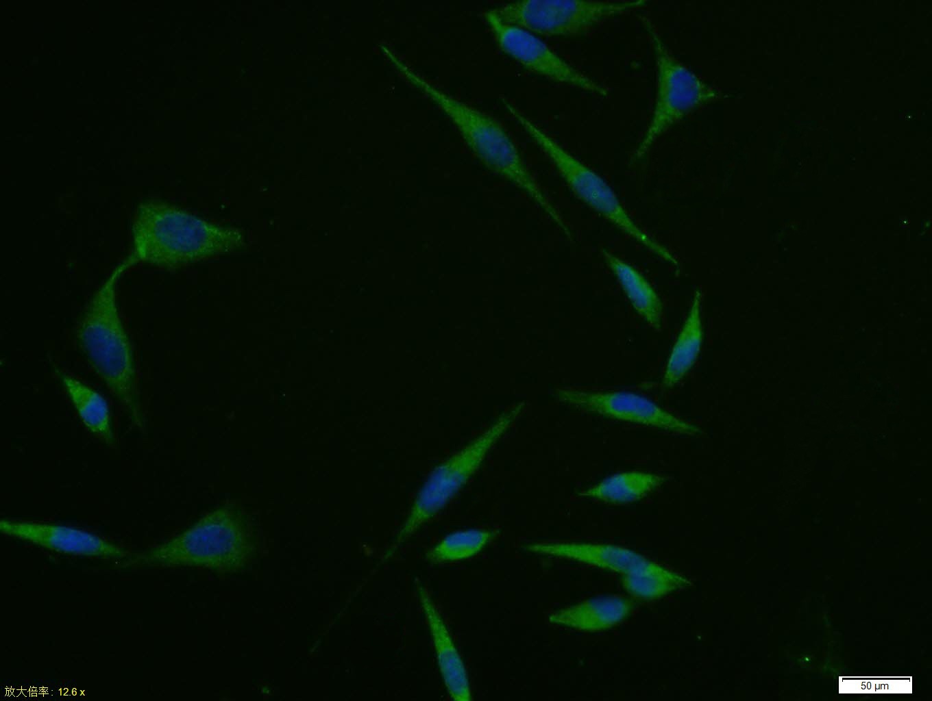 Anti-EGR1 Polyclonal Antibody