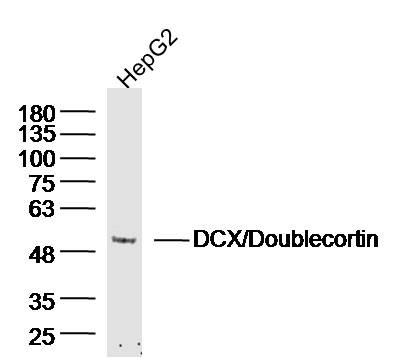 Anti-Doublecortin/DCX Polyclonal Antibody 2