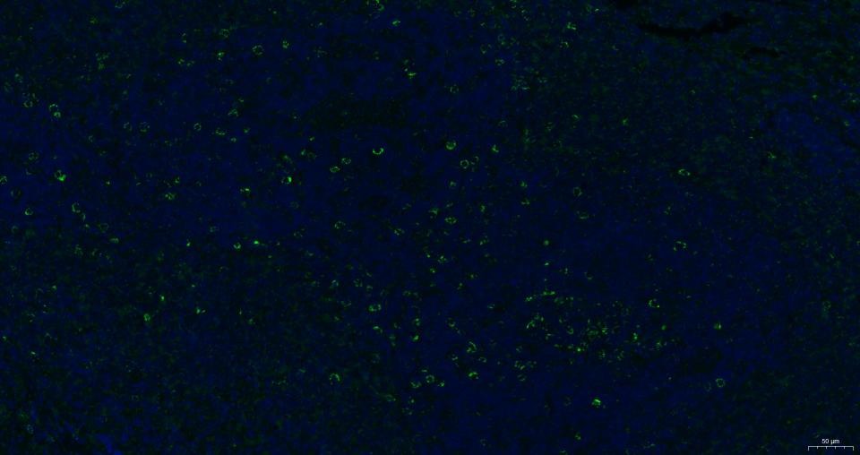 Anti-CXCR4 Polyclonal Antibody 2