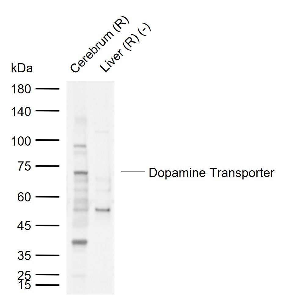 Anti-Dopamine Transporter Polyclonal Antibody