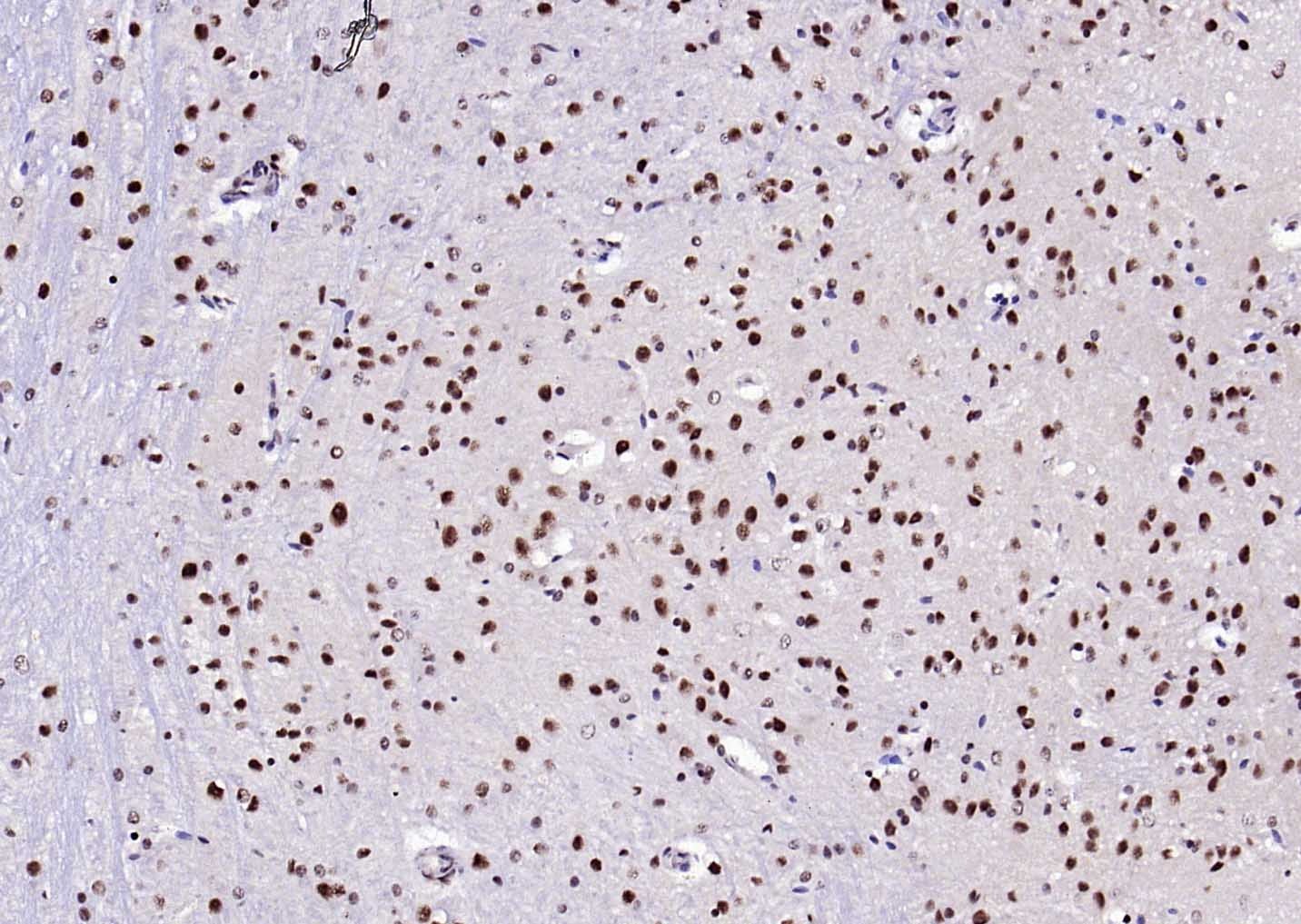 Anti-ER beta Polyclonal Antibody