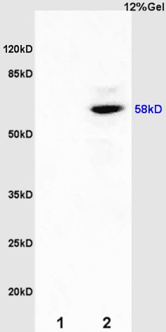 Anti-ER beta Polyclonal Antibody