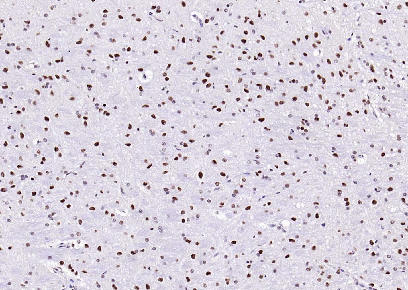 Anti-ER beta Polyclonal Antibody