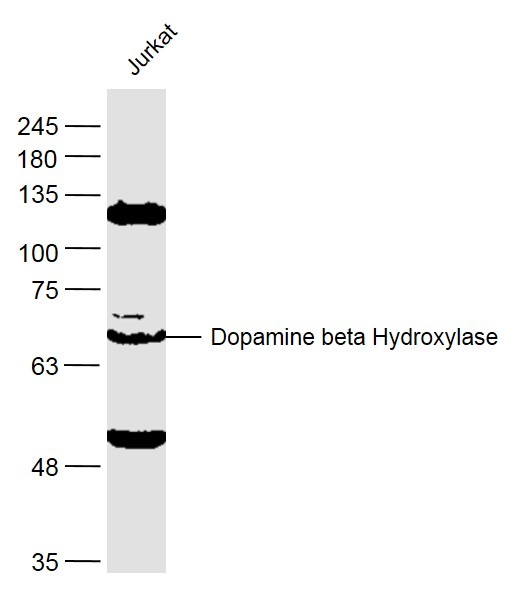 Anti-Dopamine beta-Hydroxylase Polyclonal Antibody