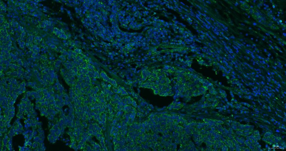 Anti-CXCR4 Polyclonal Antibody 2