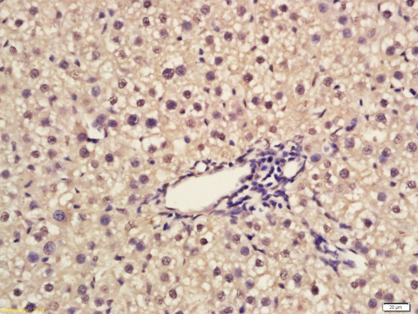 Anti-EGR1 Polyclonal Antibody