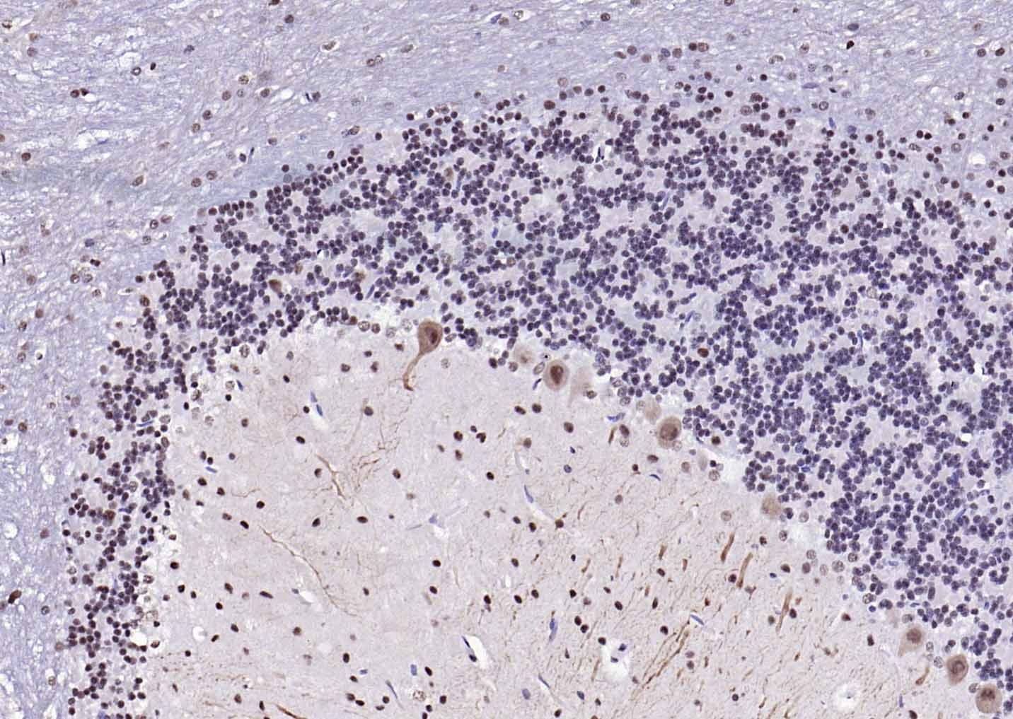 Anti-ER beta Polyclonal Antibody