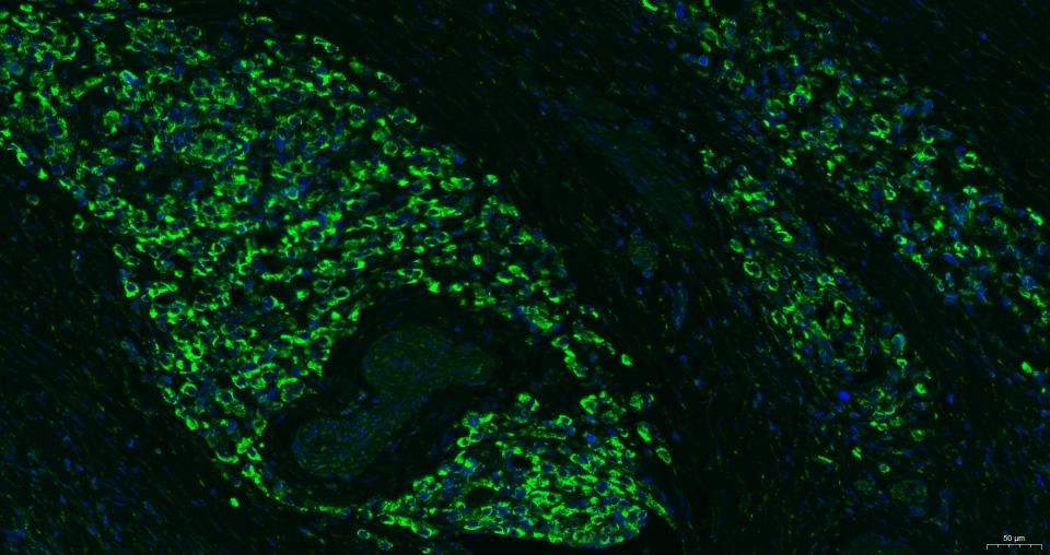 Anti-CXCR4 Polyclonal Antibody 2