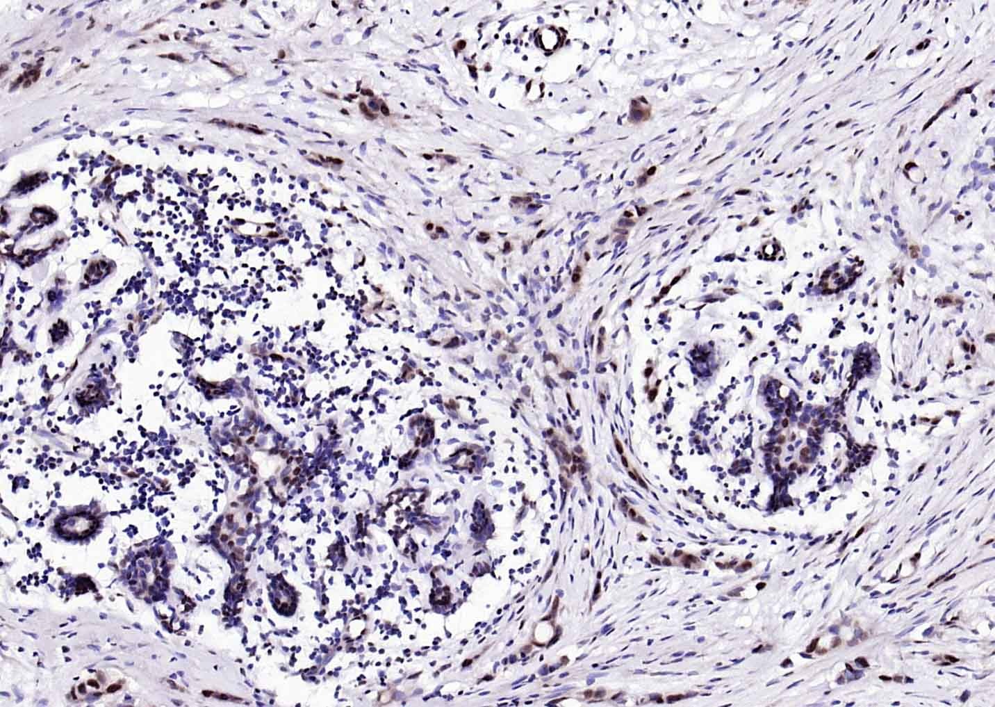 Anti-ER beta Polyclonal Antibody